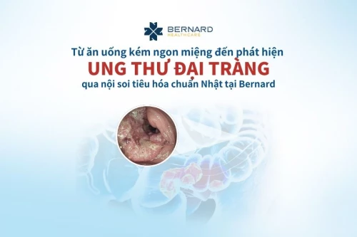 Ăn uống kém, người phụ nữ phát hiện ung thư đại tràng khi nội soi tiêu hóa tại Bernard Healthcare